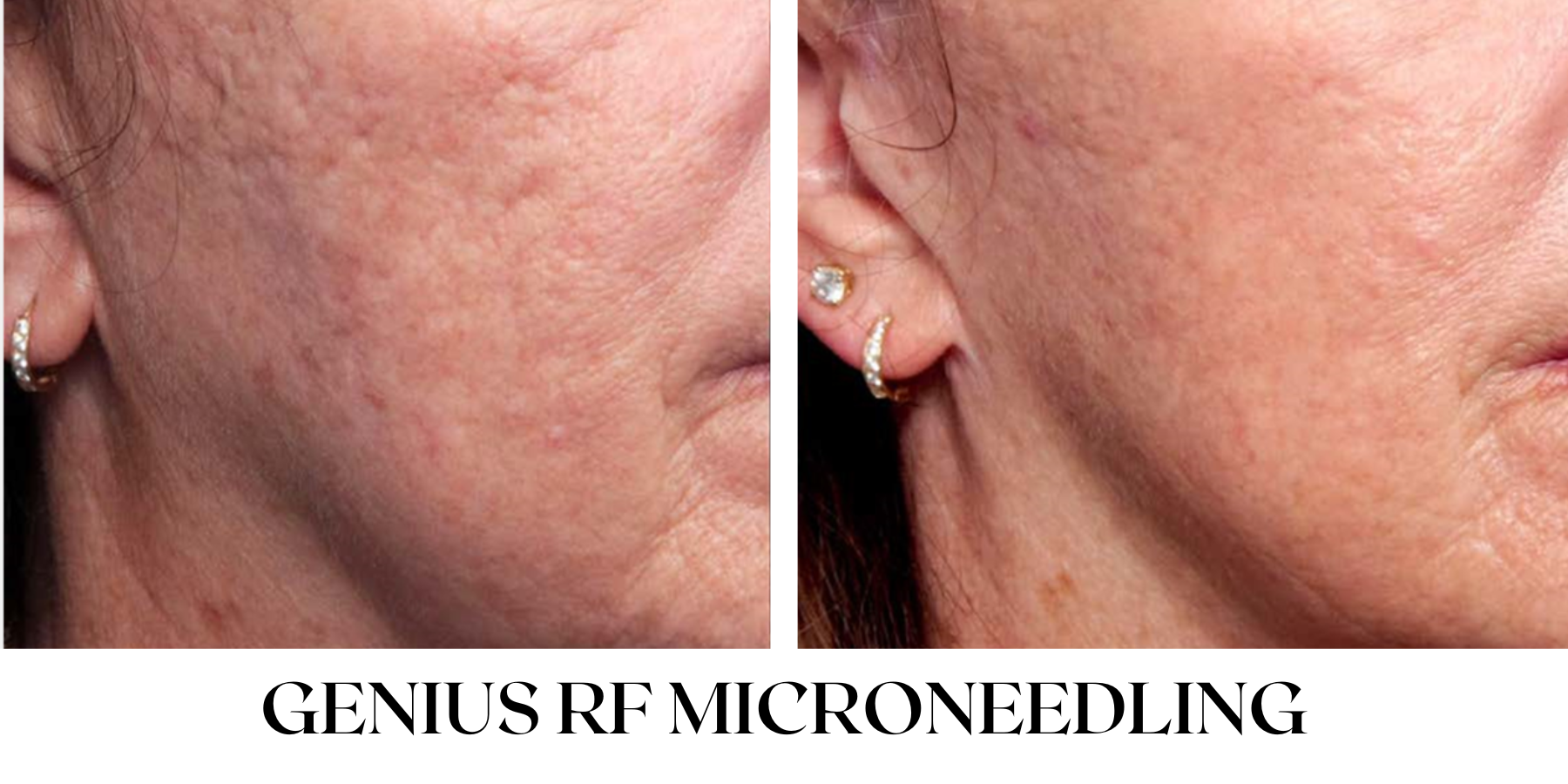 Before and After — Julia's Skin Care & Spa